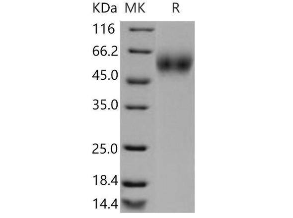 Mouse CD200R1 Recombinant Protein (RPES3819)