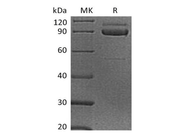 Human Cadherin-3/CDH3 Recombinant Protein (RPES3822)
