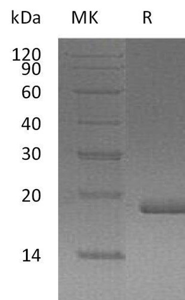 Human FGF0/FGF10 Recombinant Protein (RPES3823)