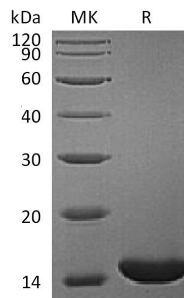 Human RBP1 Recombinant Protein (RPES3825)