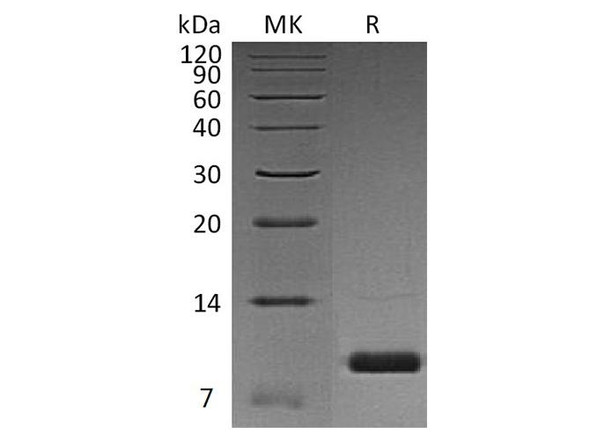 Human Uteroglobin/SCGB1A1 Recombinant Protein (RPES3832)