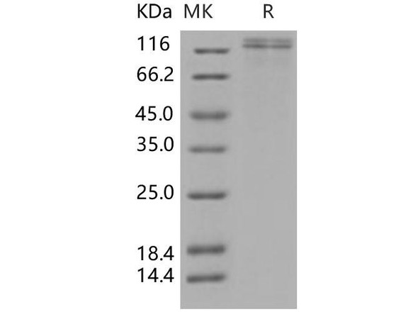 Human VLDLR/VLDL Receptor Recombinant Protein (RPES3836)