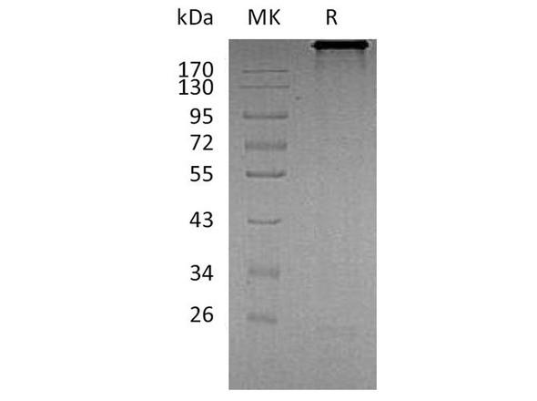 Human Cadherin-6/CDH6 Recombinant Protein (RPES3843)