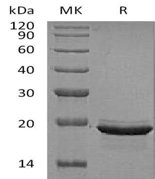 Human FGF2/FGF12 Recombinant Protein  (RPES3844)