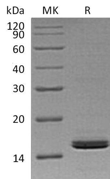 Human RBP2 Recombinant Protein (RPES3846)