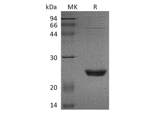 Human UBE2M/UBC12 Recombinant Protein (RPES3853)