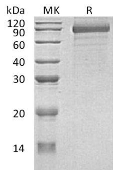 Human Cadherin-8/CDH8 Recombinant Protein (RPES3865)