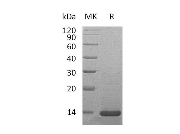 Mouse beta-NGF/NGFB Recombinant Protein (RPES3871)