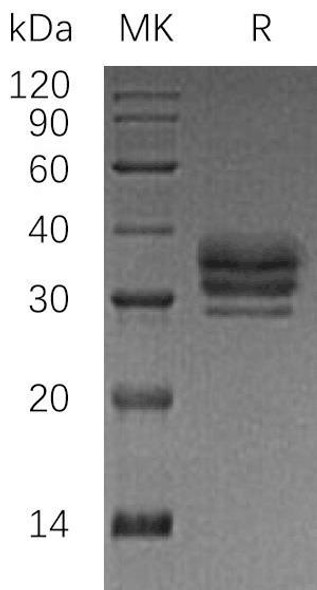 Human LTBR/TNFRSF3 Recombinant Protein (RPES3890)
