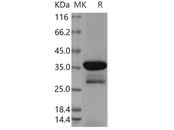 Human DCX Recombinant Protein (RPES3908)