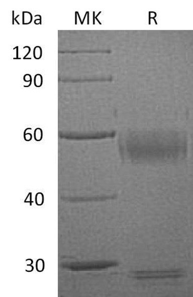 Human Ribonuclease 3/RNASE3 Recombinant Protein (RPES3913)