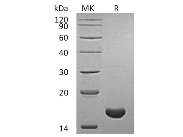 Human Cyclophilin A Recombinant Protein (RPES3919)