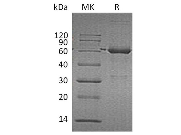 Human Catalase/CAT Recombinant Protein (RPES3921)