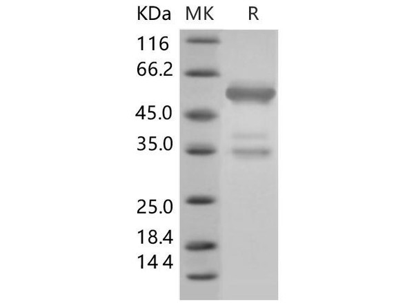 Mouse HMGB1/HMG1 Recombinant Protein (RPES3928)