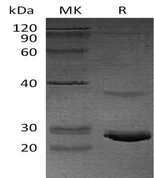 Human Calcitonin/CALCA Recombinant Protein (RPES3932)