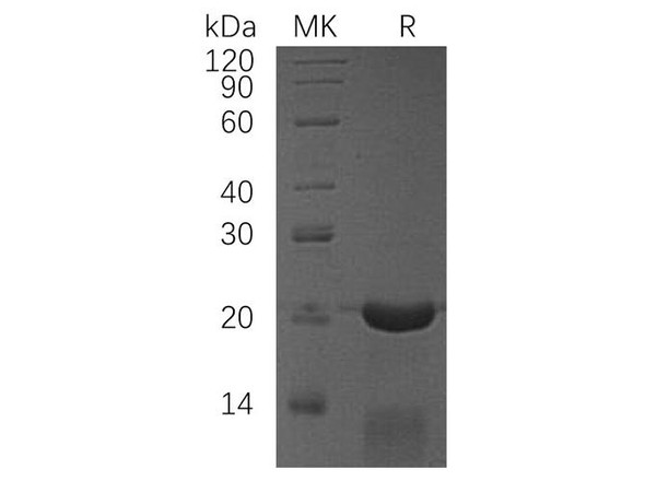 Human CRADD/RAIDD Recombinant Protein (RPES3942)