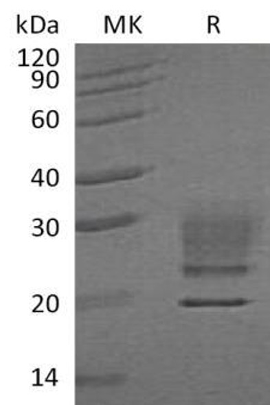Human Ribonuclease A/RNASE1 Recombinant Protein (RPES3956)