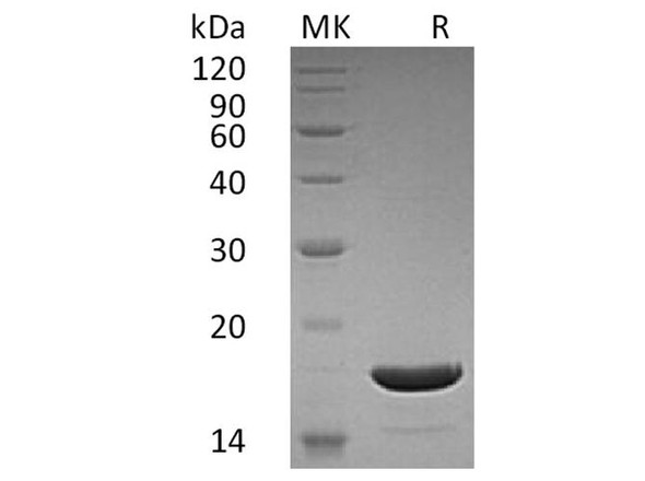 Human TRAIL Recombinant Protein  (RPES3962)