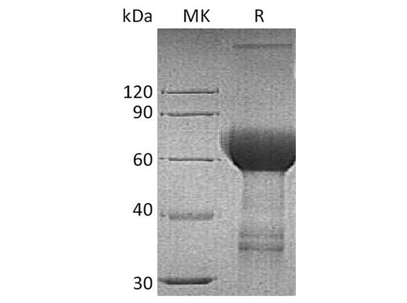 Human TROP2/TACSTD2 Recombinant Protein (RPES3963)