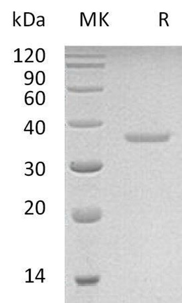 Human PRPS2 Recombinant Protein (RPES3977)