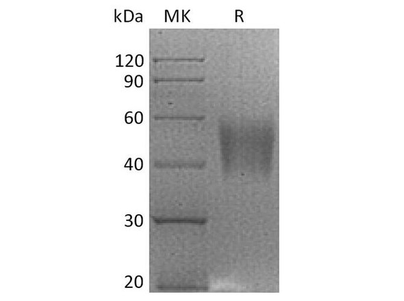 Rhesus macaque B7-H4/VTCN1 Recombinant Protein (RPES3986)