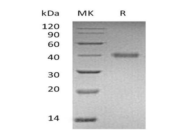 Human R-Spondin 1/RSPO1 Recombinant Protein (RPES3999)