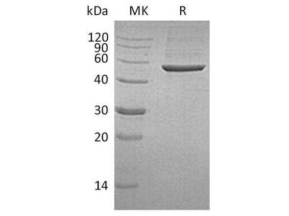 Human PGD Recombinant Protein (RPES4005)