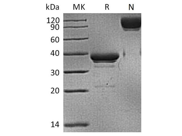 Human BCMA/TNFRSF17 Recombinant Protein (RPES4006)