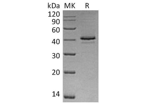 Human CAMK1/CaMKI-alpha Recombinant Protein (RPES4007)