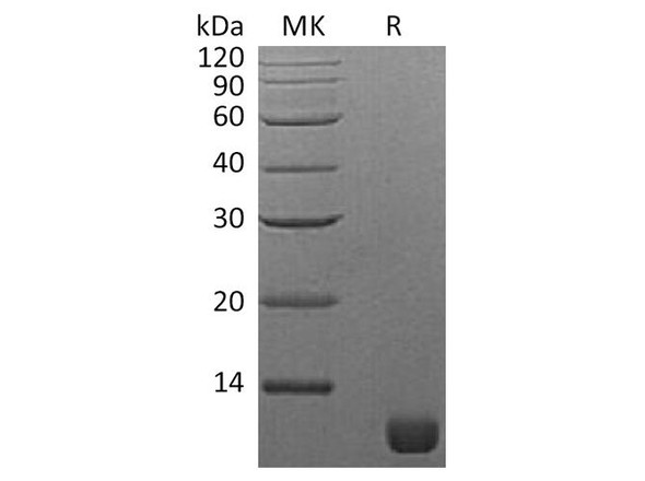 S. cerevisiae TIM16 Recombinant Protein (RPES4008)