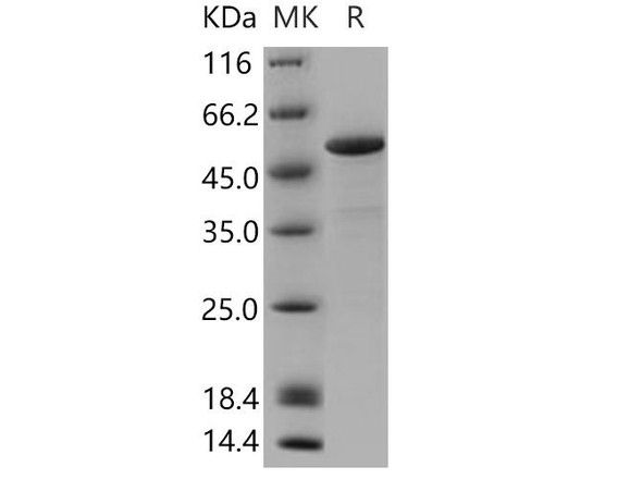 Human Calsequestrin/CASQ1 Recombinant Protein (RPES4009)