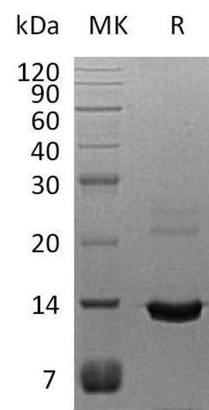 Human S100A8 Recombinant Protein (RPES4020)