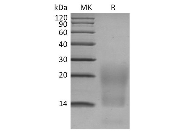 Human BCMA/TNFRSF17 Recombinant Protein (RPES4027)