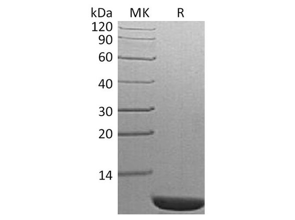 S. cerevisiae TIM14 Recombinant Protein (RPES4029)