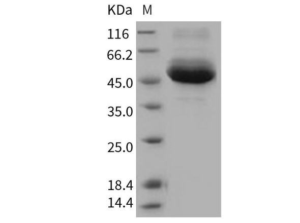 Human Cathepsin A/CTSA Recombinant Protein (RPES4038)