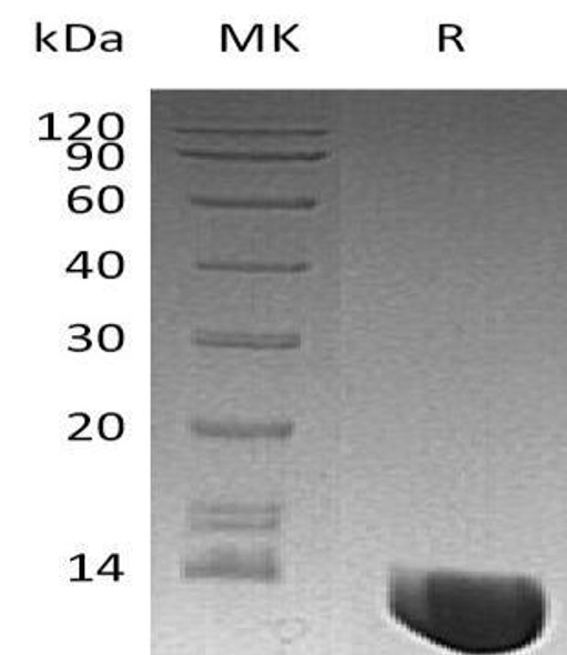 Human MIF Recombinant Protein (RPES4040)