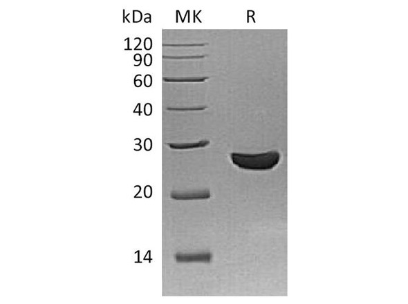 Schistosoma Japonicum GST 26 Recombinant Protein (RPES4052)