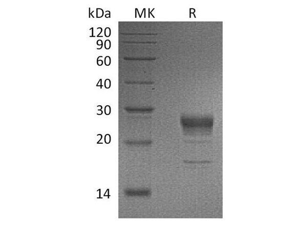 Human FGF-7/KGF Recombinant Protein (RPES4087)