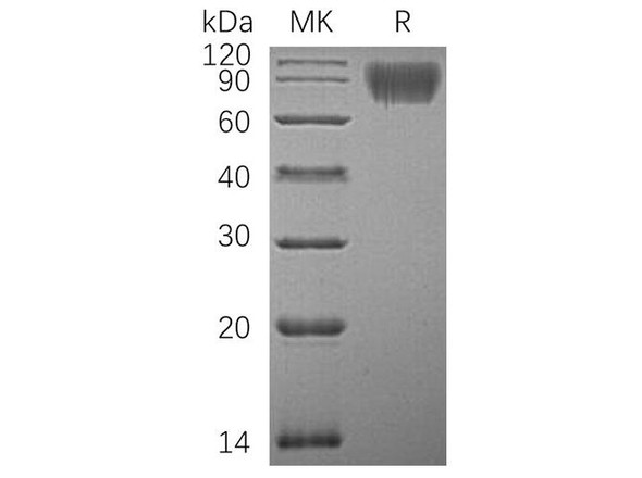 Human ICAM/CD54 Recombinant Protein (RPES4096)