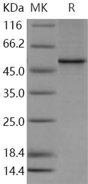Human VDR/NR1I1 Recombinant Protein (RPES4102)