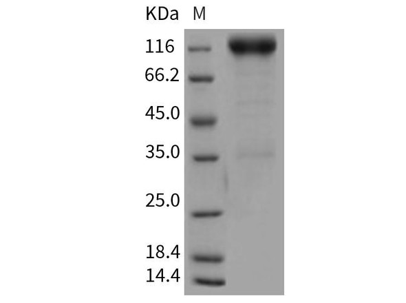 Rat PDGFRB/CD140b Recombinant Protein (RPES4105)