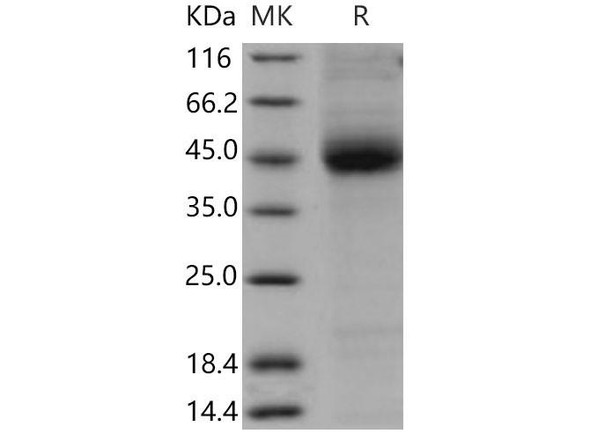 Mouse CD1D/R3G1 Recombinant Protein (RPES4107)