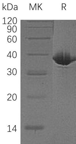 Human MDH1 Recombinant Protein (RPES4111)