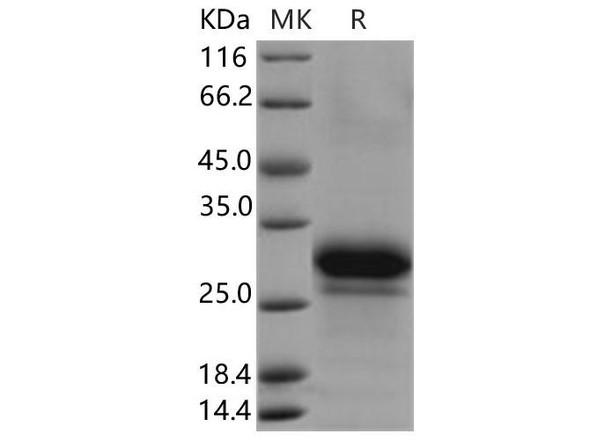 Human PPIase/FKBP7 Recombinant Protein (RPES4155)