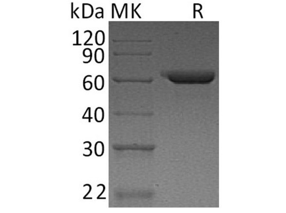 Human Fibronectin/FN Recombinant Protein  (RPES4158)