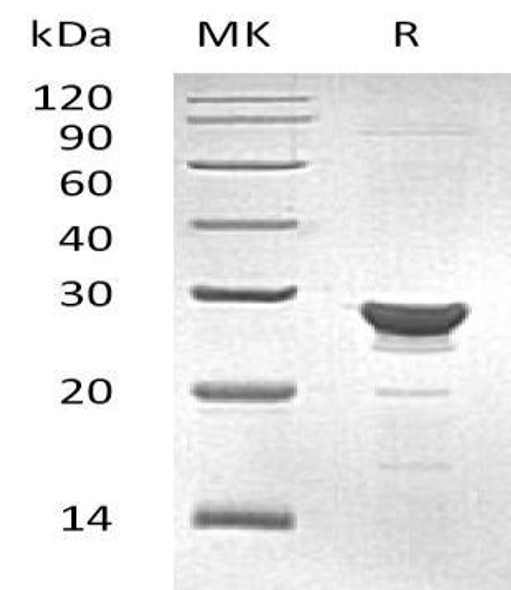 Human MAA/GSTZ1 Recombinant Protein (RPES4159)