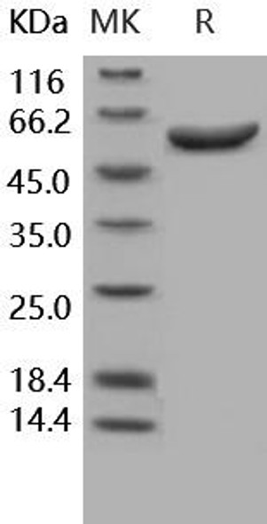 Human Arylsulfatase A/ARSA Recombinant Protein (RPES4180)