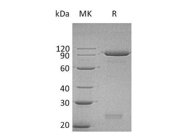 Human Semaphorin 3C/SEMA3C Recombinant Protein (RPES4184)