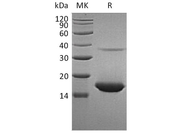 Human BIM/BCL2L11 Recombinant Protein (RPES4194)