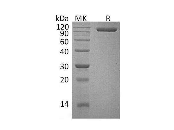 Human Semaphorin 4G/SEMA4G Recombinant Protein (RPES4208)